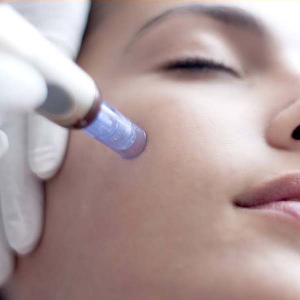 Skin Needling Redland Bay